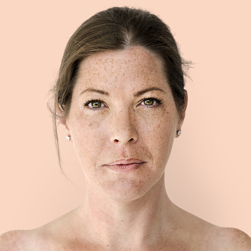 Portrait of a British woman Woman with freckled skin showcasing beauty science and wellness solutions for pigmentation issues.