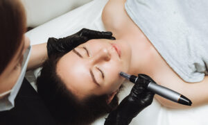 Microneedling treatment highlighting potential negative effects on skin and ageing.